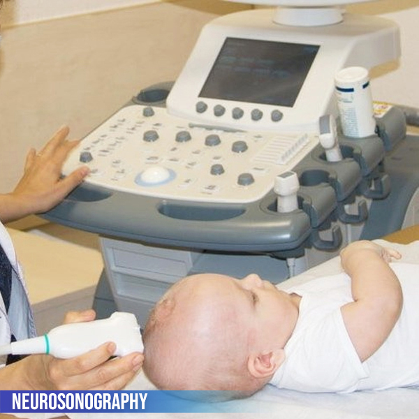 Neurosonogram and Echo